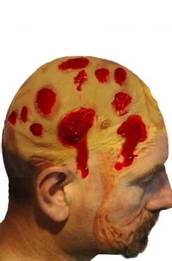 Calotta In Lattice Per Calvo Con Ustioni E Cicatrici